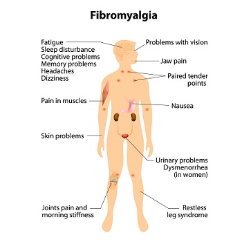 signs and symptoms of fibromyalgia. human silhouette with internal organs | Lane Chiropractic